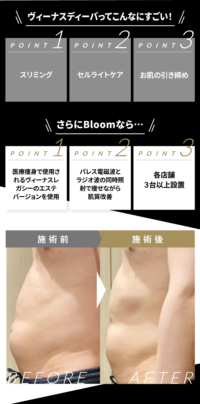 ヴィーナスディーバこんなにすごい!